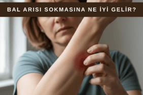 Bal arısı sokması sonrası kolunda şişlik oluşan ve kaşıntı yaşayan bir kadın